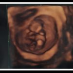 妊娠18週で胎動を毎日感じない事を心配な人へ　胎動の基礎知識